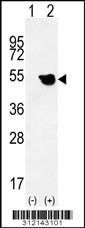 Western blot analysis of his-tag KRT13 (arrow) using his tag antibody. 293 cell lysates (2 ug/lane) either nontransfected (Lane 1) or transiently transfected with the KRT13 gene