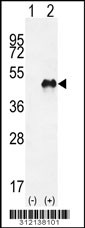 Western blot analysis of his-tag HFE (arrow) using his tag antibody. 293 cell lysates (2 ug/lane) either nontransfected (Lane 1) or transiently transfected with the HFE gene