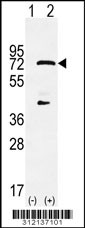 Western blot analysis of his-tag HDAC10 (arrow) using his tag antibody. 293 cell lysates (2 ug/lane) either nontransfected (Lane 1) or transiently transfected with the HDAC10 gene