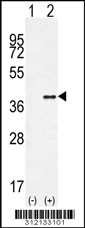 Western blot analysis of his-tag FBL (arrow) using his tag antibody. 293 cell lysates (2 ug/lane) either nontransfected (Lane 1) or transiently transfected with the FBL gene
