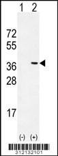Western blot analysis of his-tag EXOSC8 (arrow) using his tag antibody. 293 cell lysates (2 ug/lane) either nontransfected (Lane 1) or transiently transfected with the EXOSC8 gene