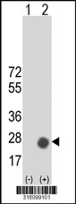 Western blot analysis of his-tag GOLT1B (arrow) using his tag antibody. 293T cell lysates (2 ug/lane) either nontransfected (Lane 1) or transiently transfected with the GOLT1B gene‘