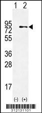 Western blot analysis of his-tag EPB42 (arrow) using his tag antibody. 293 cell lysates (2 ug/lane) either nontransfected (Lane 1) or transiently transfected with the EPB42 gene