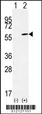 Western blot analysis of his-tag DLD (arrow) using his tag antibody. 293 cell lysates (2 ug/lane) either nontransfected (Lane 1) or transiently transfected with the DLD gene