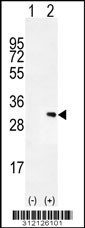 Western blot analysis of his-tag DKK2 (arrow) using his tag antibody. 293 cell lysates (2 ug/lane) either nontransfected (Lane 1) or transiently transfected with the DKK2 gene