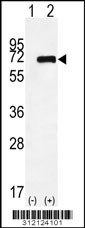 Western blot analysis of his-tag CPN2 (arrow) using his tag antibody. 293 cell lysates (2 ug/lane) either nontransfected (Lane 1) or transiently transfected with the CPN2 gene