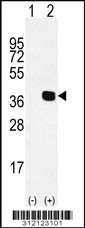 Western blot analysis of his-tag CDX4 (arrow) using his tag antibody. 293 cell lysates (2 ug/lane) either nontransfected (Lane 1) or transiently transfected with the CDX4 gene