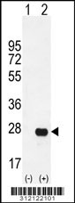 Western blot analysis of his-tag CDX1 (arrow) using his tag antibody. 293 cell lysates (2 ug/lane) either nontransfected (Lane 1) or transiently transfected with the CDX1 gene