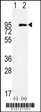 Western blot analysis of his-tag CDH1 (arrow) using his tag antibody. 293 cell lysates (2 ug/lane) either nontransfected (Lane 1) or transiently transfected with the CDH1 gene