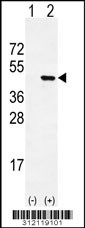 Western blot analysis of his-tag BARX2 (arrow) using his tag antibody. 293 cell lysates (2 ug/lane) either nontransfected (Lane 1) or transiently transfected with the BARX2 gene