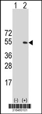 Western blot analysis of his-tag GCM1 (arrow) using his tag antibody. 293T cell lysates (2 ug/lane) either nontransfected (Lane 1) or transiently transfected with the GCM1 gene‘
