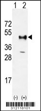 Western blot analysis of his-tag ATP1B2 (arrow) using his tag antibody. 293 cell lysates (2 ug/lane) either nontransfected (Lane 1) or transiently transfected with the ATP1B2 gene