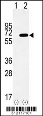 Western blot analysis of his-tag ATIC (arrow) using his tag antibody. 293 cell lysates (2 ug/lane) either nontransfected (Lane 1) or transiently transfected with the ATIC gene