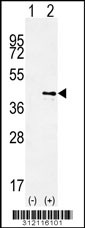 Western blot analysis of his-tag APOL1 (arrow) using his tag antibody. 293 cell lysates (2 ug/lane) either nontransfected (Lane 1) or transiently transfected with the APOL1 gene