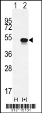 Western blot analysis of his-tag APOA4 (arrow) using his tag antibody. 293 cell lysates (2 ug/lane) either nontransfected (Lane 1) or transiently transfected with the APOA4 gene