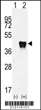 Western blot analysis of his-tag ALDOA (arrow) using his tag antibody. 293 cell lysates (2 ug/lane) either nontransfected (Lane 1) or transiently transfected with the ALDOA gene