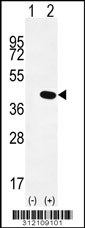 Western blot analysis of his-tag ACAT2 (arrow) using his tag antibody. 293 cell lysates (2 ug/lane) either nontransfected (Lane 1) or transiently transfected with the ACAT2 gene