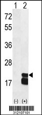 Western blot analysis of his-tag UPK1A (arrow) using his tag antibody. 293 cell lysates (2 ug/lane) either nontransfected (Lane 1) or transiently transfected with the UPK1A gene
