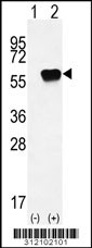 Western blot analysis of his-tag SETD7 (arrow) using his tag antibody. 293 cell lysates (2 ug/lane) either nontransfected (Lane 1) or transiently transfected with the SETD7 gene