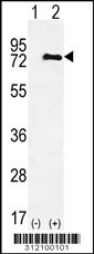 Western blot analysis of his-tag ABCB8 (arrow) using his tag antibody. 293 cell lysates (2 ug/lane) either nontransfected (Lane 1) or transiently transfected with the ABCB8 gene