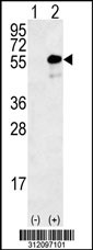 Western blot analysis of his-tag MAPT (arrow) using his tag antibody. 293 cell lysates (2 ug/lane) either nontransfected (Lane 1) or transiently transfected with the MAPT gene