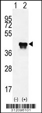Western blot analysis of his-tag KIR3DS1 (arrow) using his tag antibody. 293 cell lysates (2 ug/lane) either nontransfected (Lane 1) or transiently transfected with the KIR3DS1 gene