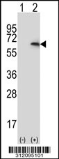 Western blot analysis of his-tag IRAK2 (arrow) using his tag antibody. 293 cell lysates (2 ug/lane) either nontransfected (Lane 1) or transiently transfected with the IRAK2 gene