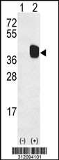 Western blot analysis of his-tag HOXB1 (arrow) using his tag antibody. 293 cell lysates (2 ug/lane) either nontransfected (Lane 1) or transiently transfected with the HOXB1 gene