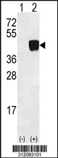 Western blot analysis of his-tag EPN3 (arrow) using his tag antibody. 293 cell lysates (2 ug/lane) either nontransfected (Lane 1) or transiently transfected with the EPN3 gene