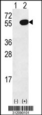 Western blot analysis of his-tag CYP2A6 (arrow) using his tag antibody. 293 cell lysates (2 ug/lane) either nontransfected (Lane 1) or transiently transfected with the CYP2A6 gene