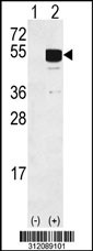 Western blot analysis of his-tag CYP24A1 (arrow) using his tag antibody. 293 cell lysates (2 ug/lane) either nontransfected (Lane 1) or transiently transfected with the CYP24A1 gene
