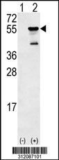 Western blot analysis of his-tag CKMT1B (arrow) using his tag antibody. 293 cell lysates (2 ug/lane) either nontransfected (Lane 1) or transiently transfected with the CKMT1B gene