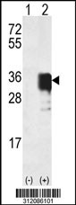 Western blot analysis of his-tag ADIPOQ (arrow) using his tag antibody. 293 cell lysates (2 ug/lane) either nontransfected (Lane 1) or transiently transfected with the ADIPOQ gene