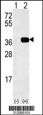 Western blot analysis of his-tag TBP (arrow) using his tag antibody. 293 cell lysates (2 ug/lane) either nontransfected (Lane 1) or transiently transfected with the TBP gene
