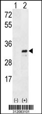 Western blot analysis of his-tag PAX4 (arrow) using his tag antibody. 293 cell lysates (2 ug/lane) either nontransfected (Lane 1) or transiently transfected with the PAX4 gene