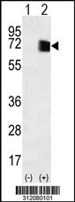 Western blot analysis of his-tag GPC6 (arrow) using his tag antibody. 293 cell lysates (2 ug/lane) either nontransfected (Lane 1) or transiently transfected with the GPC6 gene