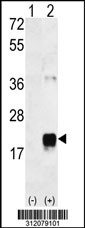 Western blot analysis of his-tag FSHB (arrow) using his tag antibody. 293 cell lysates (2 ug/lane) either nontransfected (Lane 1) or transiently transfected with the FSHB gene