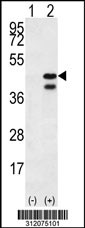 Western blot analysis of his-tag ALDOC (arrow) using his tag antibody. 293 cell lysates (2 ug/lane) either nontransfected (Lane 1) or transiently transfected with the ALDOC gene