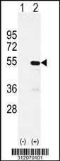 Western blot analysis of his-tag TRAIP (arrow) using his tag antibody. 293 cell lysates (2 ug/lane) either nontransfected (Lane 1) or transiently transfected with the TRAIP gene