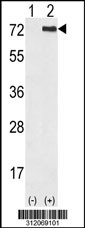 Western blot analysis of his-tag TP73 (arrow) using his tag antibody. 293 cell lysates (2 ug/lane) either nontransfected (Lane 1) or transiently transfected with the TP73 gene