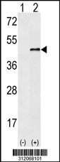 Western blot analysis of his-tag TNFAIP2 (arrow) using his tag antibody. 293 cell lysates (2 ug/lane) either nontransfected (Lane 1) or transiently transfected with the TNFAIP2 gene