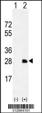 Western blot analysis of his-tag SOST (arrow) using his tag antibody. 293 cell lysates (2 ug/lane) either nontransfected (Lane 1) or transiently transfected with the SOST gene
