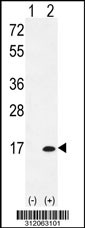 Western blot analysis of his-tag SNRPF (arrow) using his tag antibody. 293 cell lysates (2 ug/lane) either nontransfected (Lane 1) or transiently transfected with the SNRPF gene