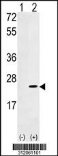 Western blot analysis of his-tag RPL24 (arrow) using his tag antibody. 293 cell lysates (2 ug/lane) either nontransfected (Lane 1) or transiently transfected with the RPL24 gene
