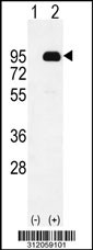 Western blot analysis of his-tag PRKCA (arrow) using his tag antibody. 293 cell lysates (2 ug/lane) either nontransfected (Lane 1) or transiently transfected with the PRKCA gene