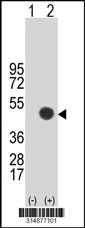 Western blot analysis of his-tag GRAP2 (arrow) using his tag antibody. 293T cell lysates (2 ug/lane) either nontransfected (Lane 1) or transiently transfected with the GRAP2 gene‘
