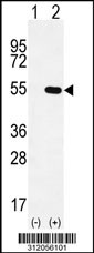 Western blot analysis of his-tag PACSIN3 (arrow) using his tag antibody. 293 cell lysates (2 ug/lane) either nontransfected (Lane 1) or transiently transfected with the PACSIN3 gene