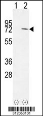 Western blot analysis of his-tag NEK8 (arrow) using his tag antibody. 293 cell lysates (2 ug/lane) either nontransfected (Lane 1) or transiently transfected with the NEK8 gene