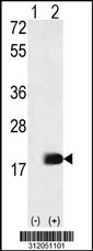 Western blot analysis of his-tag NANOS2 (arrow) using his tag antibody. 293 cell lysates (2 ug/lane) either nontransfected (Lane 1) or transiently transfected with the NANOS2 gene