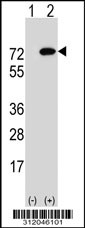 Western blot analysis of his-tag LTV1 (arrow) using his tag antibody. 293 cell lysates (2 ug/lane) either nontransfected (Lane 1) or transiently transfected with the LTV1 gene